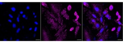 Invitrogen PHD3 Recombinant Rabbit Monoclonal Antibody (23GB5275) 20 &mu;L | Buy Online | Invitrogen&trade; | Fisher Scientific