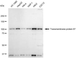 Invitrogen TMEM67 Recombinant Rabbit Monoclonal Antibody (23GB4990), Invitrogen
