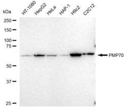 Invitrogen PMP70 Recombinant Rabbit Monoclonal Antibody (23GB5010), Invitrogen