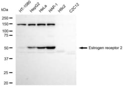 Invitrogen Estrogen Receptor beta Recombinant Rabbit Monoclonal Antibody