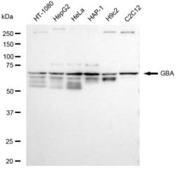Invitrogen&trade;&nbsp;GBA Recombinant Rabbit Monoclonal Antibody (23GB5775)