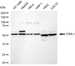 Invitrogen PAR2 Recombinant Rabbit Monoclonal Antibody (23GB5850), Invitrogen 100 &mu;L | Buy Online | Invitrogen&trade; | Fisher Scientific