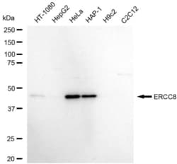 Invitrogen ERCC8 Recombinant Rabbit Monoclonal Antibody (23GB5905), Invitrogen