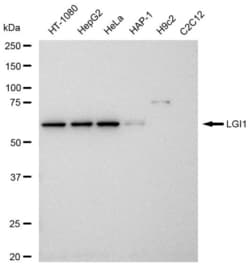Invitrogen LGI1 Recombinant Rabbit Monoclonal Antibody (23GB5930), Invitrogen