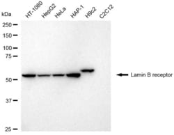 Invitrogen Lamin B Receptor Recombinant Rabbit Monoclonal Antibody (23GB6100),