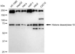 Invitrogen HDAC10 Recombinant Rabbit Monoclonal Antibody (23GB6165), Invitrogen 20 &mu;L | Buy Online | Invitrogen&trade; | Fisher Scientific