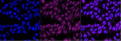 Invitrogen HLA-G Recombinant Rabbit Monoclonal Antibody (23GB6225), Invitrogen