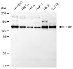 Invitrogen MDA5 Recombinant Rabbit Monoclonal Antibody (23GB6270), Invitrogen