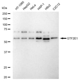 Invitrogen GTF2E1 Recombinant Rabbit Monoclonal Antibody (23GB6310), Invitrogen
