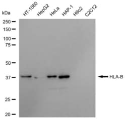 Invitrogen HLA-B Recombinant Rabbit Monoclonal Antibody (23GB6375), Invitrogen