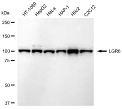Invitrogen&trade;&nbsp;LGR6 Recombinant Rabbit Monoclonal Antibody (23GB6400)