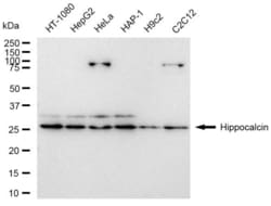 Invitrogen Hippocalcin Recombinant Rabbit Monoclonal Antibody (23GB6405),
