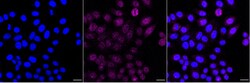 Invitrogen GRB7 Recombinant Rabbit Monoclonal Antibody (23GB6445):Antibodies:Primary
