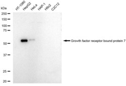Invitrogen&trade;&nbsp;GRB7 Recombinant Rabbit Monoclonal Antibody (23GB6445)