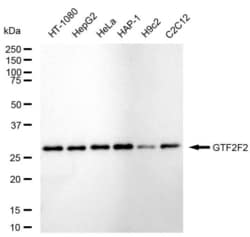 Invitrogen GTF2F2 Recombinant Rabbit Monoclonal Antibody (23GB6490), Invitrogen
