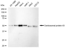 Invitrogen FGFR1OP Recombinant Rabbit Monoclonal Antibody (23GB5705), Invitrogen