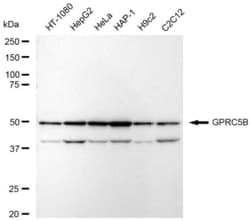 Invitrogen GPRC5B Recombinant Rabbit Monoclonal Antibody (23GB5710), Invitrogen