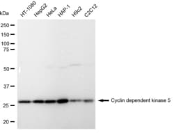 Invitrogen CDK5 Recombinant Rabbit Monoclonal Antibody (23GB1425):Antibodies:Primary