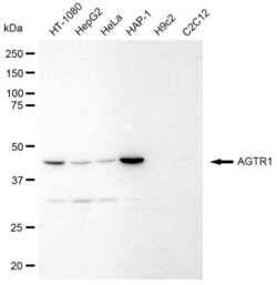 Invitrogen AGTR1 Recombinant Rabbit Monoclonal Antibody (23GB635), Invitrogen