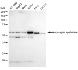 Invitrogen Asparagine Synthetase Recombinant Rabbit Monoclonal Antibody
