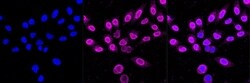 Invitrogen&trade;&nbsp;HSPB8 Recombinant Rabbit Monoclonal Antibody (23GB1980)