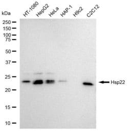 Invitrogen HSPB8 Recombinant Rabbit Monoclonal Antibody (23GB1980) 20 &mu;L | Buy Online | Invitrogen&trade; | Fisher Scientific