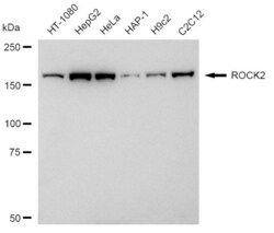 Invitrogen ROCK2 Recombinant Rabbit Monoclonal Antibody (23GB2030), Invitrogen