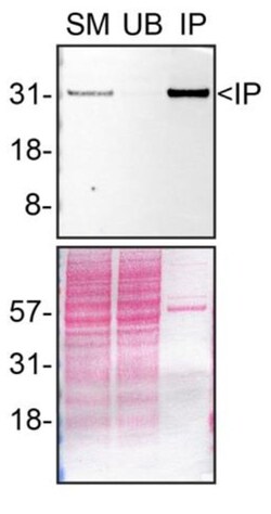 Invitrogen Syntenin 1 Recombinant Rabbit Monoclonal Antibody (23GB2185), Invitrogen 20 &mu;L | Buy Online | Invitrogen&trade; | Fisher Scientific