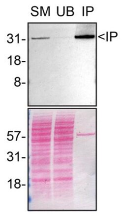 Invitrogen Syntenin 1 Recombinant Rabbit Monoclonal Antibody (23GB2185), Invitrogen 20 &mu;L | Buy Online | Invitrogen&trade; | Fisher Scientific