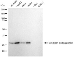 Invitrogen Syntenin 1 Recombinant Rabbit Monoclonal Antibody (23GB2185), Invitrogen 20 &mu;L | Buy Online | Invitrogen&trade; | Fisher Scientific