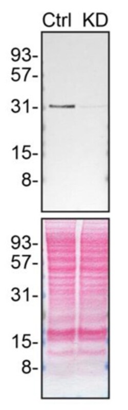 Invitrogen Syntenin 1 Recombinant Rabbit Monoclonal Antibody (23GB2185), Invitrogen 20 &mu;L | Buy Online | Invitrogen&trade; | Fisher Scientific