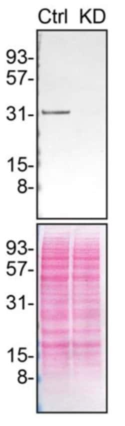 Invitrogen Syntenin 1 Recombinant Rabbit Monoclonal Antibody (23GB2185), Invitrogen 20 &mu;L | Buy Online | Invitrogen&trade; | Fisher Scientific