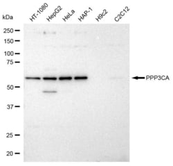 Invitrogen Calcineurin A Recombinant Rabbit Monoclonal Antibody (23GB2855),