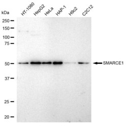 Invitrogen BAF57 Recombinant Rabbit Monoclonal Antibody (23GB2810) 20 &mu;L | Buy Online | Invitrogen&trade; | Fisher Scientific