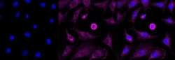 Invitrogen&trade;&nbsp;AP2S1 Recombinant Rabbit Monoclonal Antibody (23GB2980)