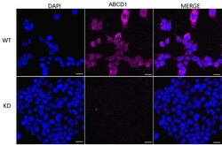 Invitrogen ABCD1 Recombinant Rabbit Monoclonal Antibody (23GB3125), Invitrogen