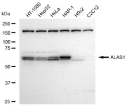 Invitrogen ALAS1 Recombinant Rabbit Monoclonal Antibody (23GB3190), Invitrogen