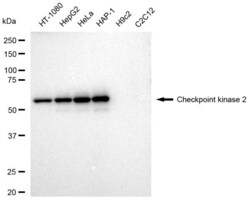 Invitrogen CHK2 Recombinant Rabbit Monoclonal Antibody (23GB3460), Invitrogen
