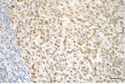 Invitrogen Caspase 3 p12 Recombinant Rabbit Monoclonal Antibody (23GB3310), Invitrogen 20 &mu;L | Buy Online | Invitrogen&trade; | Fisher Scientific