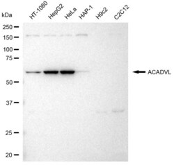 Invitrogen ACADVL Recombinant Rabbit Monoclonal Antibody (23GB3615), Invitrogen 100 &mu;L | Buy Online | Invitrogen&trade; | Fisher Scientific