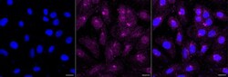 Invitrogen MMP14 Recombinant Rabbit Monoclonal Antibody (23GB2695), Invitrogen