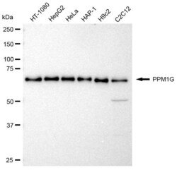 Invitrogen PPM1G Recombinant Rabbit Monoclonal Antibody (23GB2585) 20 &mu;L | Buy Online | Invitrogen&trade; | Fisher Scientific