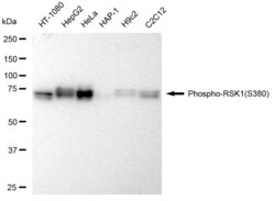 Invitrogen Phospho-RSK1 (Ser380) Recombinant Rabbit Monoclonal Antibody (23GB2425) 20 &mu;L | Buy Online | Invitrogen&trade; | Fisher Scientific
