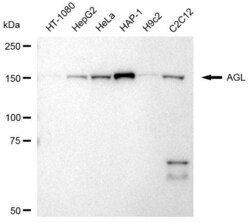 Invitrogen AGL Recombinant Rabbit Monoclonal Antibody (23GB2965), Invitrogen