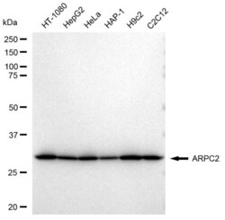 Invitrogen ARPC2 Recombinant Rabbit Monoclonal Antibody (23GB2985), Invitrogen