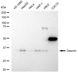 Invitrogen Desmin Recombinant Rabbit Monoclonal Antibody (23GB3120), Invitrogen 100 &mu;L | Buy Online | Invitrogen&trade; | Fisher Scientific