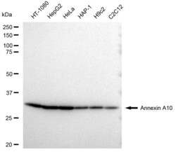 Invitrogen Annexin A10 Recombinant Rabbit Monoclonal Antibody (23GB3215),