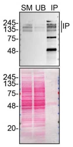 Invitrogen ARID1A Recombinant Rabbit Monoclonal Antibody (23GB3230), Invitrogen 20 &mu;L | Buy Online | Invitrogen&trade; | Fisher Scientific