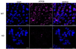 Invitrogen ATP Synthase beta Recombinant Rabbit Monoclonal Antibody (23GB3255),