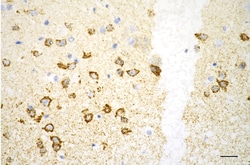 Invitrogen ATP Synthase beta Recombinant Rabbit Monoclonal Antibody (23GB3255),